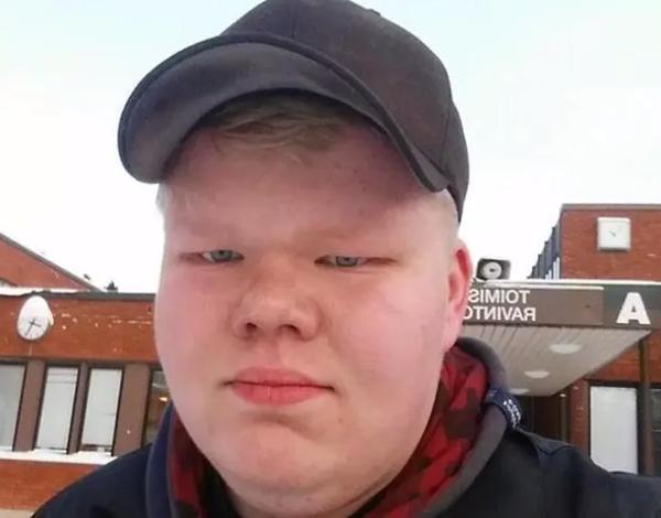 混血儿智商高颜值好真实情况颠覆你对混血宝宝的美好期待