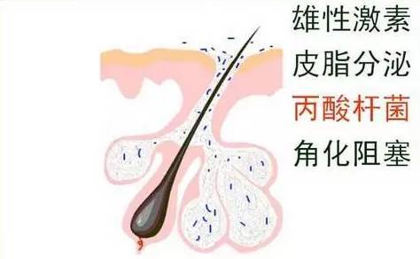 消之宝