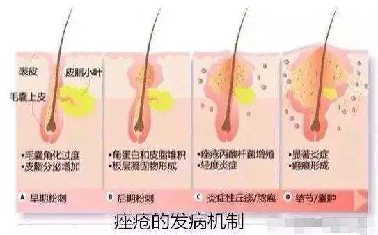 消之宝