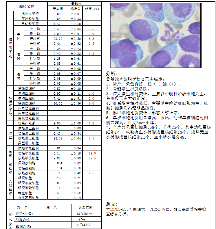 什么外周血成熟单核细胞显著增高竟然是急性白血病