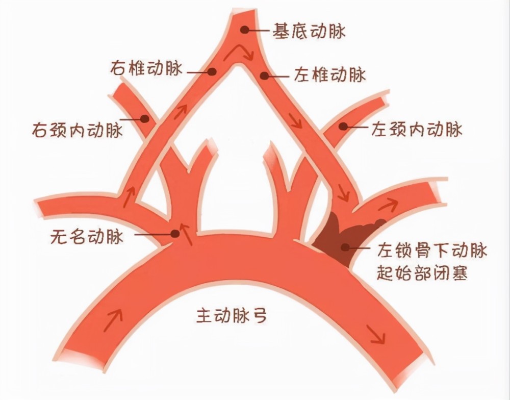 无名动脉分叉处位置图图片