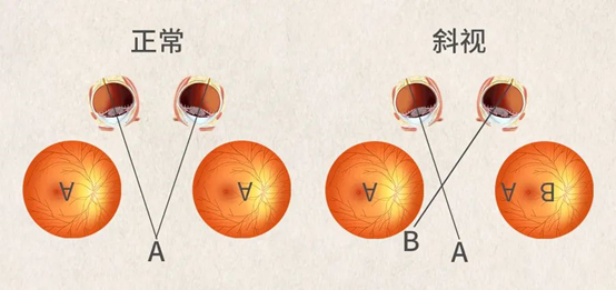 斜视图的作用图片