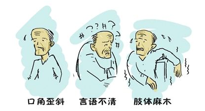 中风前兆!身体向你发出的3个暗号,收到1个能救命!