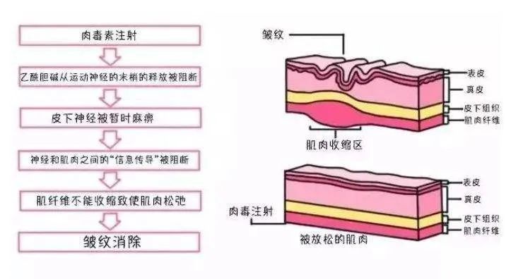 芯片校招大战：刚毕业年薪40w，VC/PE也看懵了补墙裂缝