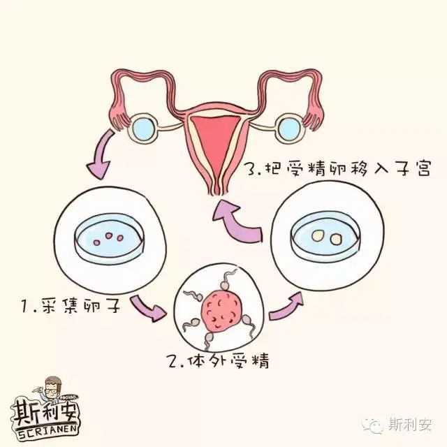 什么叫物质还需医保试管为止