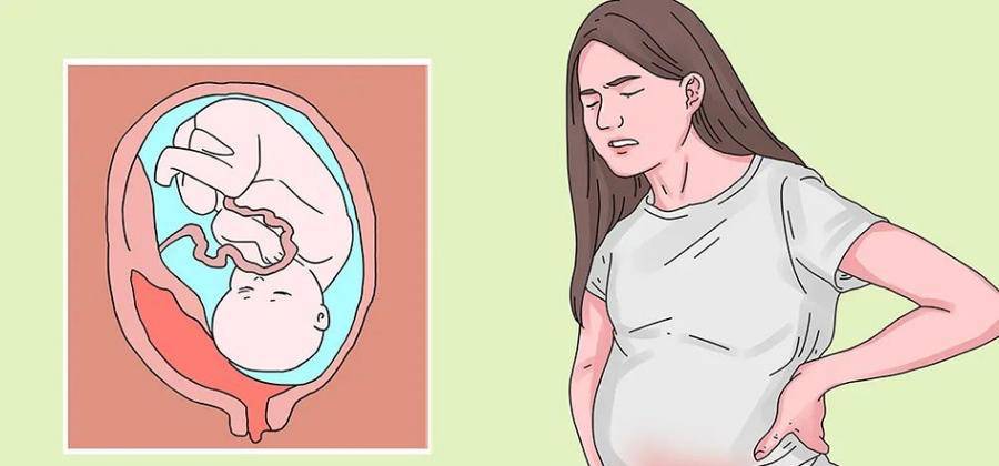 双胎孕妇胎盘早剥仅用20分钟母婴3人化险为夷