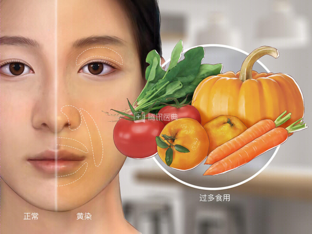 没错,吃橘子太多确实会变成"小黄人",使人变黄的现象叫做"橘黄症","