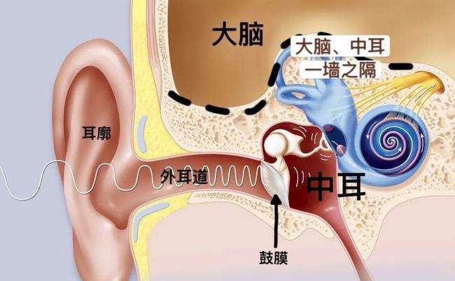 乘坐飞机几天后耳朵还有闷堵感医生提醒可能是中耳炎