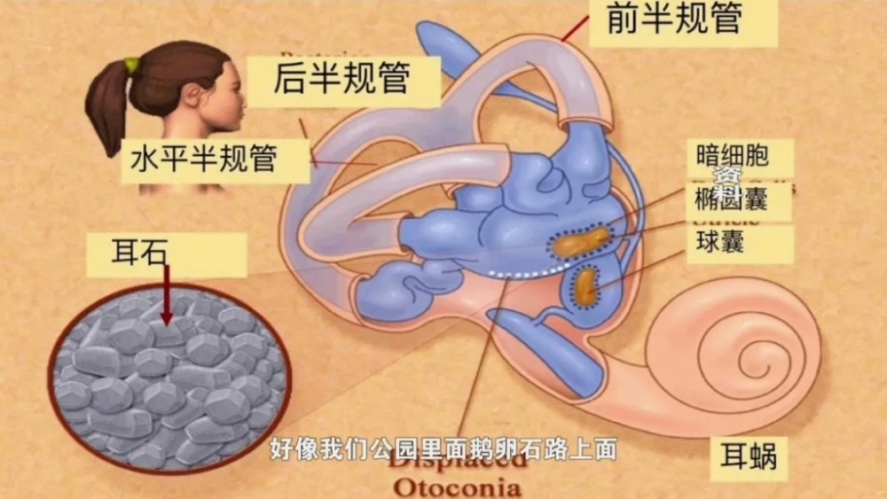 求证丨全国爱耳日带你认识一下耳石症