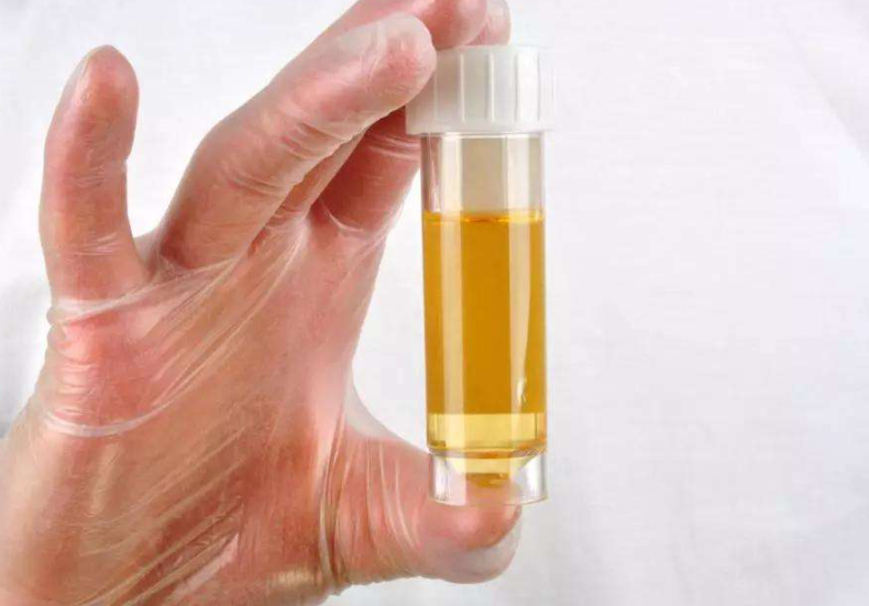 如果前列腺出现问题,就会导致前列腺液无法正常地排出和分泌,进而会