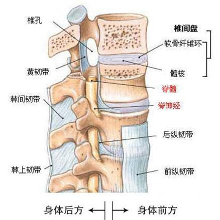 同样都是椎间盘为何你的就如此突出