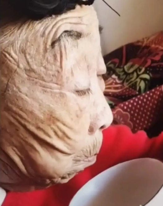 85岁马玉琴拉皮副作用明显皮肤过度松弛网友以为是木雕