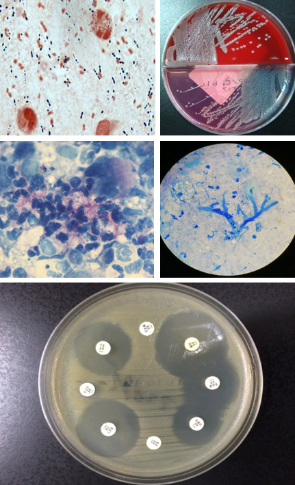 细菌涂片及培养,真菌涂片及培养,厌氧菌培养;1,传统的形态和生化:临床