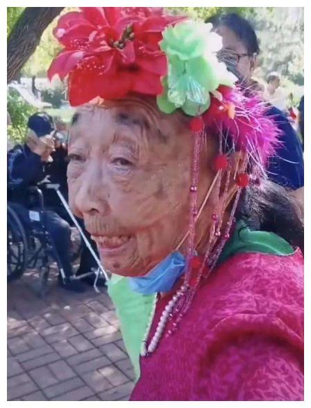 85岁马玉琴拉皮副作用明显,皮肤过度松弛,网友:以为是木雕