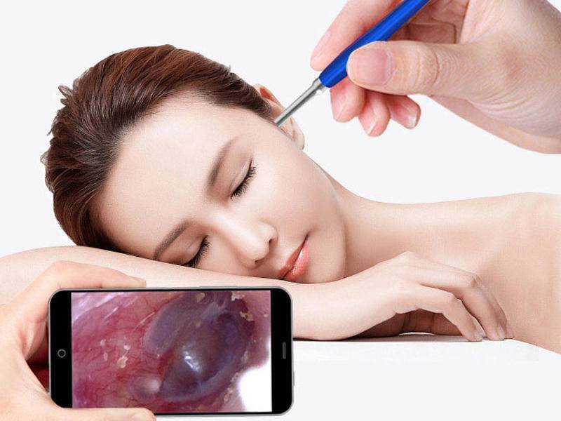 可视挖耳勺走红网络它能带来掏耳自由吗