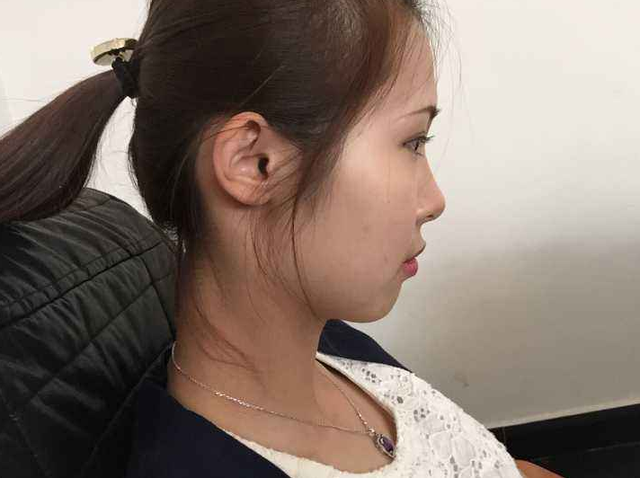 长辈的观念要改了!睡扁头不但没福气还影响智商,长大还容易大饼脸