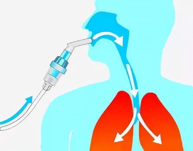 吸痰利用负压原理进行吸痰术,吸痰要点注意严格执行无菌操作,从深部
