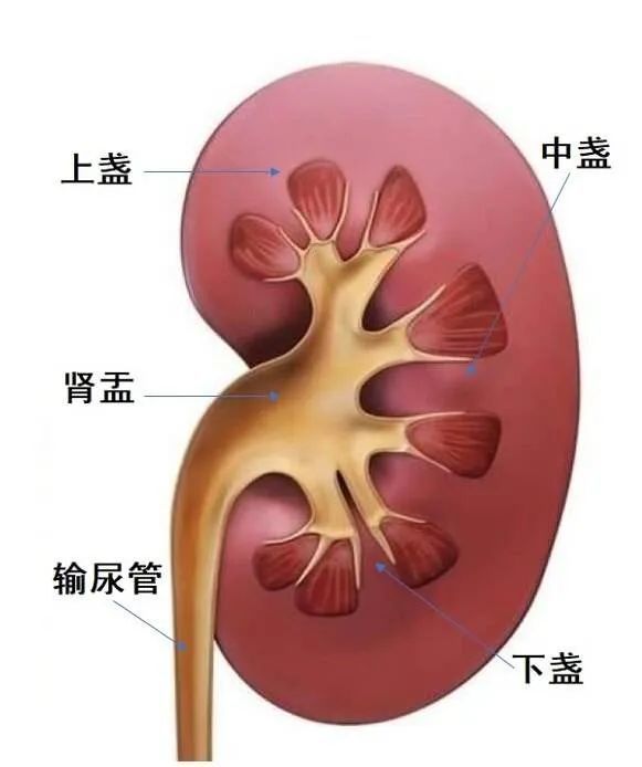肾结石往下排的过程图图片