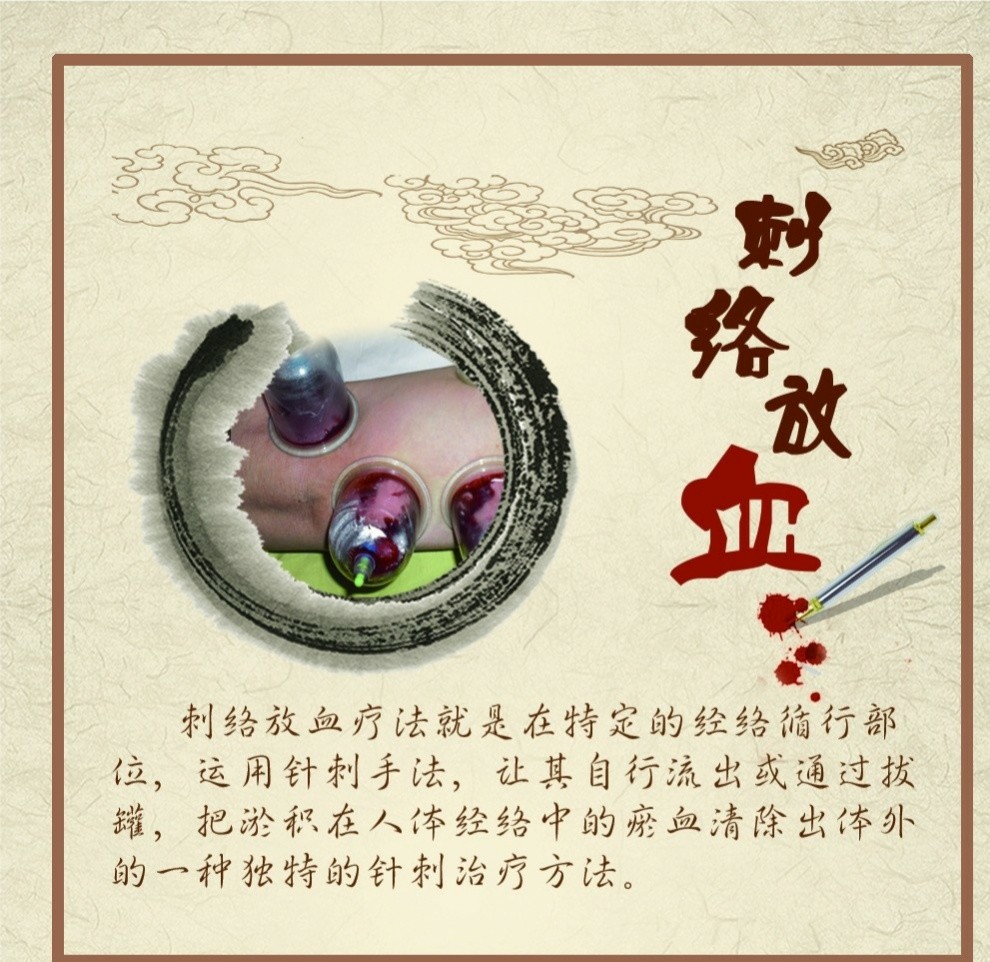 8 刺血拔罐法放血拔罐法是刺络法与拔罐联合使用的一种方法,一般用