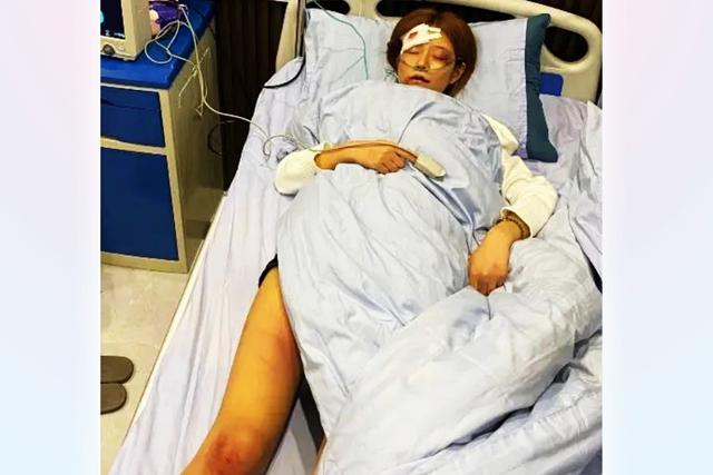 百万网红王多鱼遭家暴鼻青脸肿昏迷不醒其母哭诉男友无情