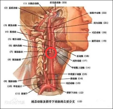 医生用注射器扎我儿子的颈动脉…你或许对"颈动脉"有什么误解?