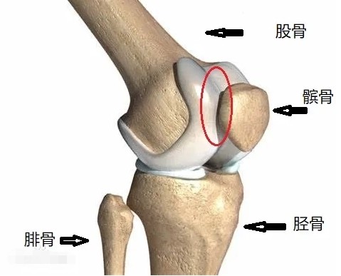 髌骨软化的原因,离不开3大诱因,不少人还在犯
