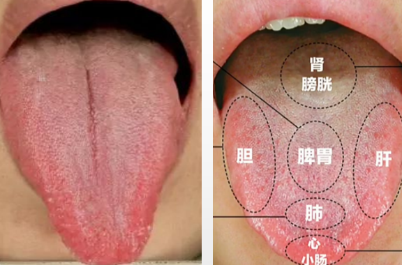 反酸燒心多是肝火犯胃簡單6味中藥滋補肝陰疏解肝氣