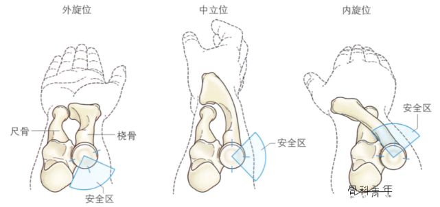 相关节,在桡骨小头固定过程中,需将钢板放置于不影响桡骨头旋转位置