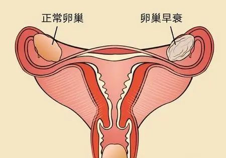 00後女孩長期只吃沙拉或水果節食減肥,被確診為卵巢早衰……●長3 3