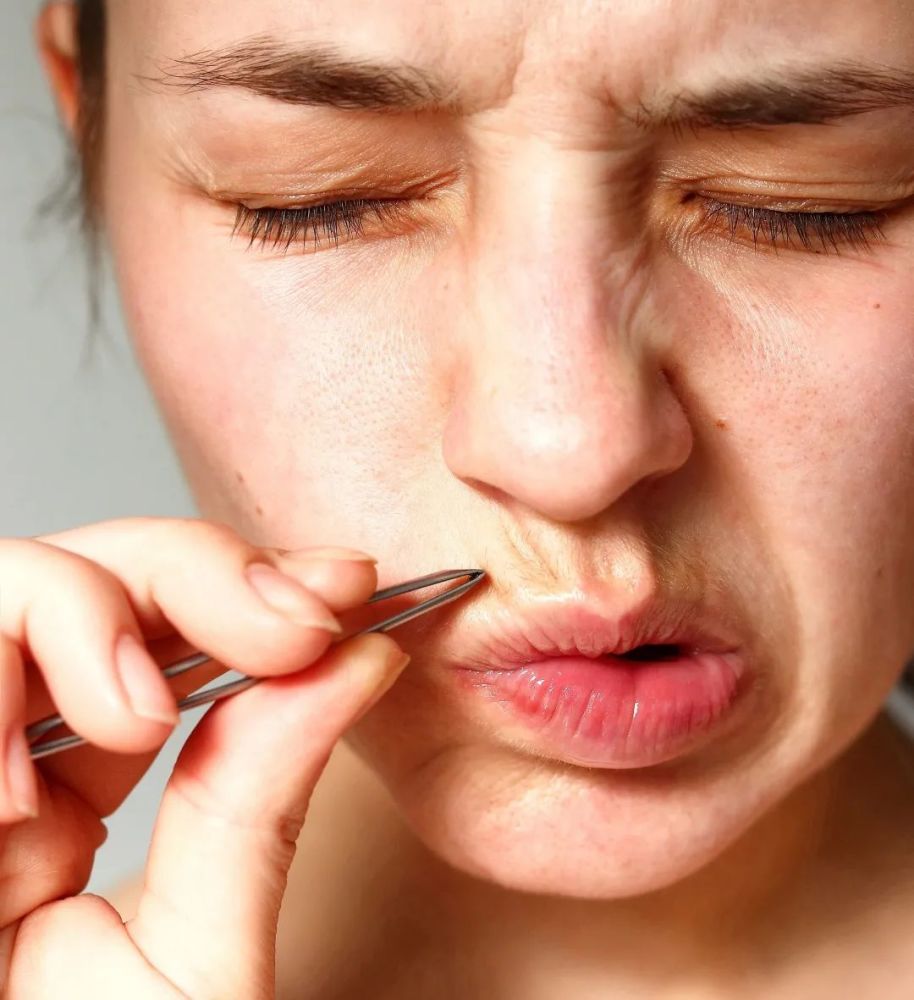 女生长小胡子体毛多不一定是不健康