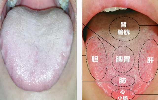 脾虛用歸脾丸上火怎麼辦一劑香砂六君丸既補脾又健脾化溼