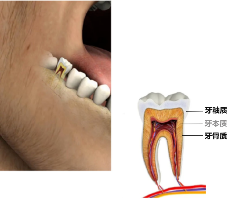 孕期牙齿酸酸软软难道是宝宝把钙质吸走了