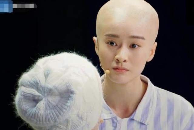 而且,她的光头从侧面看后脑勺鼓鼓的,从正面看头顶圆,两侧方,正常人能