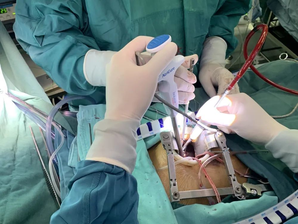 3月8日,在麻醉手术部专家团队的保驾护航下,闫炀教授带领团队顺利为雷