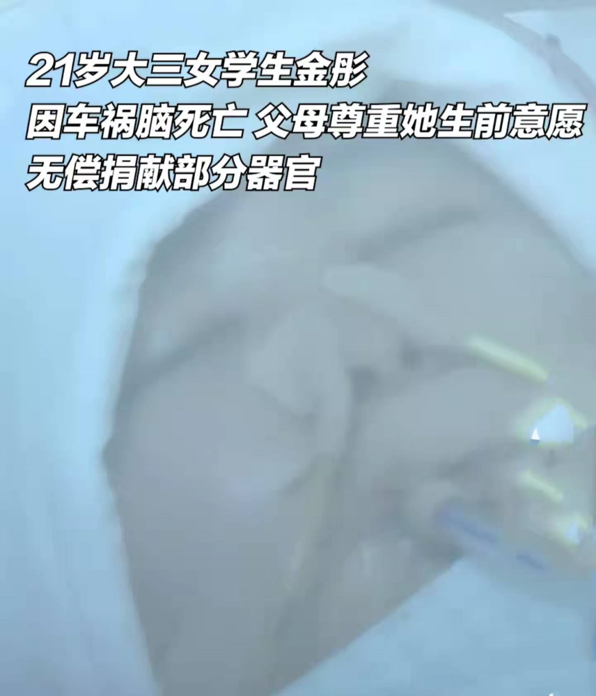 台州姑娘21岁女学生因为车祸导致脑死亡生前遗愿是捐献器官