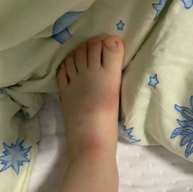 3岁小孩费力地挠着脚背,双脚互相蹭