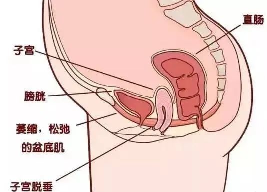 生孩子让女孩变大妈产后恢复了解一下