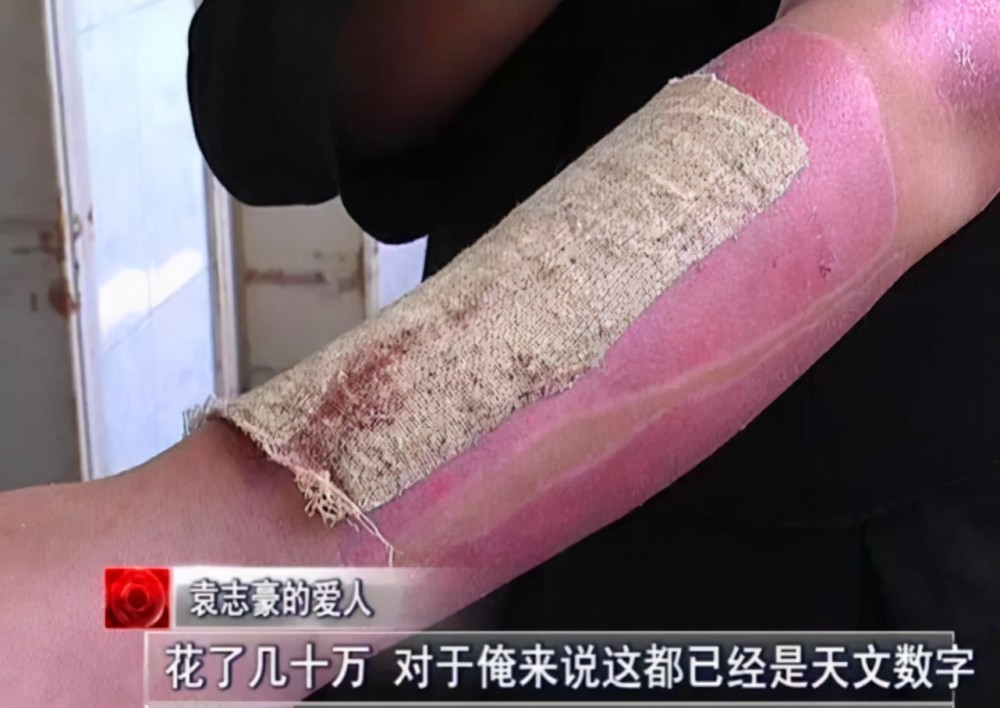 已经委婉地建议放弃的情况下,妻子侯二妮对丈夫袁志豪不抛弃,不放弃