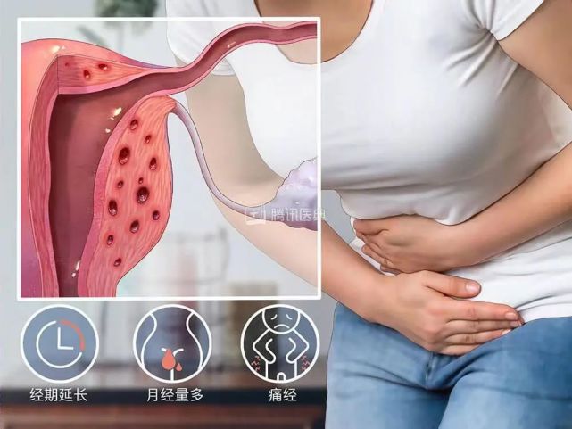 42岁的我选择切除子宫,但没想到还有更大的代价……|子宫|月经|卵巢