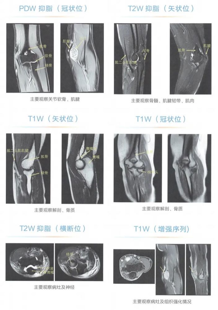 mri丨肘关节mri检查技术