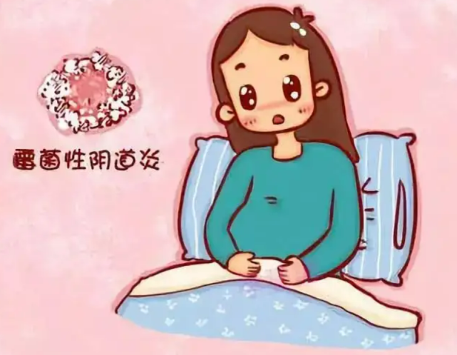 阴道炎前期释放的信号你遇到过几个?早点知道,别大意|阴道炎|妇科疾病