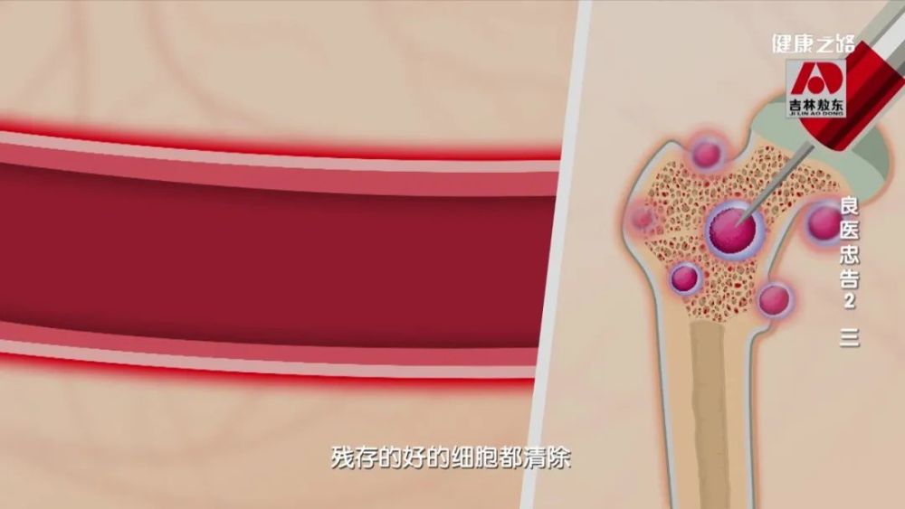 预告记忆力差牙龈出血身体出现小红点小心血液病在作祟