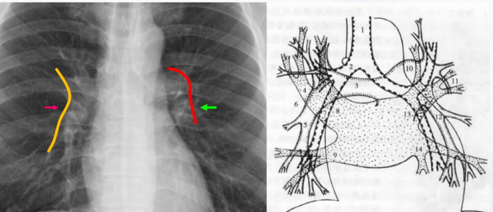 没有不会读胸片的医生只有