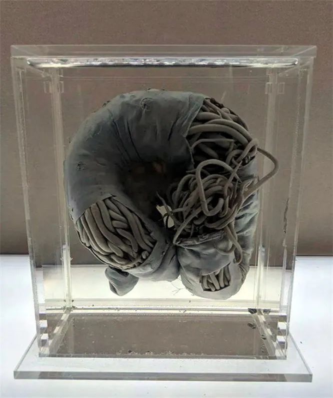 头皮发麻 头皮发麻发紧是什么病的前兆