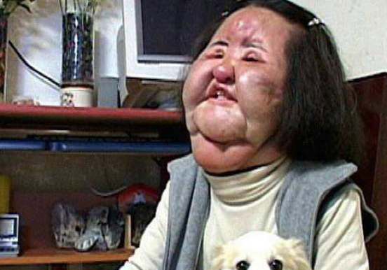 韩慧景将这一切都归咎于自己精致大气的脸庞,于是想到了整容变美的