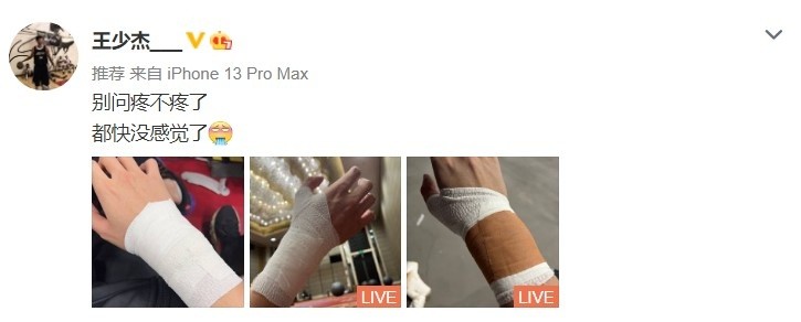 王少杰更博晒手腕包扎照别问疼不疼了都快没感觉了