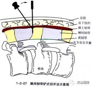 實用針刀解剖示意圖