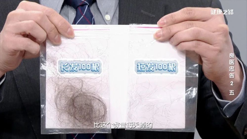 100根头发有多少图图片