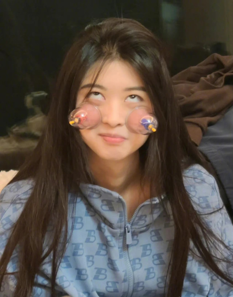 这半永久腮红整挺好高原10年都没这个好