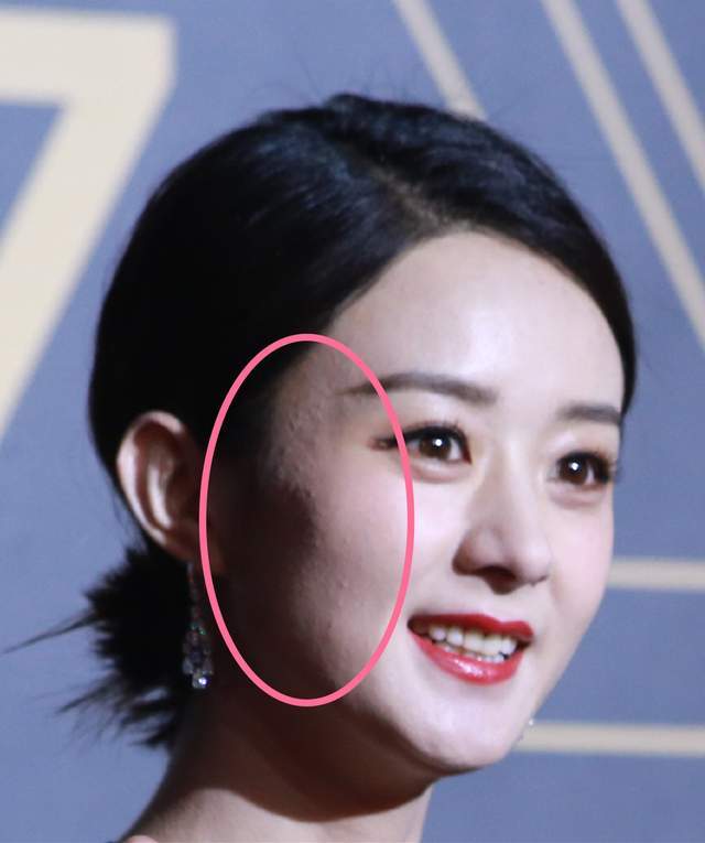 明星生图赫敏抬头纹法令纹真实呈现水果姐浓妆盖不住毛孔